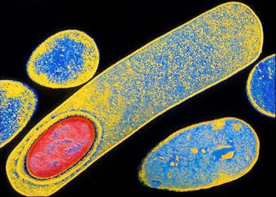 Does an Ultrasonic Cleaner Kill Bacteria